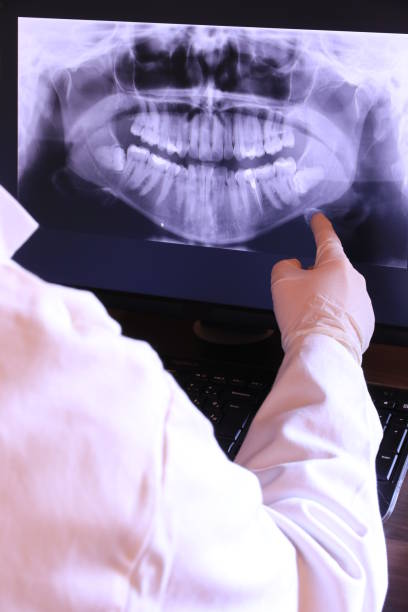 Best Emergency Broken Tooth Repair in Massapequa, NY